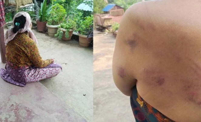 बोक्सी झार्ने भन्दै मेलमिलापकर्ता महिलामाथि निर्मम  कुटपिट